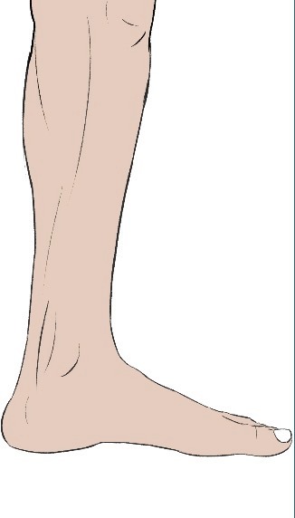 Sample photo for the inside view of the left foot.